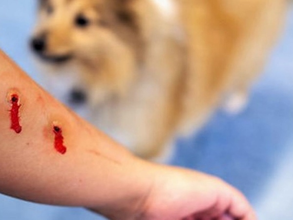 Nằm mơ thấy bị chó cắn là điềm gì, dữ hay lành?