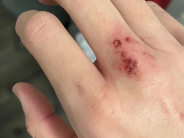 Nằm mơ thấy bị chó cắn là điềm gì, dữ hay lành?